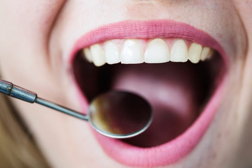 Parodontologia a Palermo: proteggere gengive e ossa per un sorriso sano